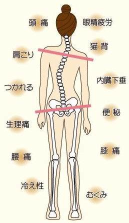 体の歪み