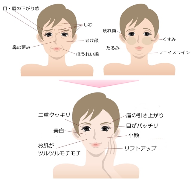 小顔 リフトアップ 美肌 門真の整体 他院の先生を技術指導する技術力 元氣カイロプラクティック院 小顔 リフトアップ 美肌 門真の整体 他院の先生を技術指導する技術力 元氣カイロプラクティック院