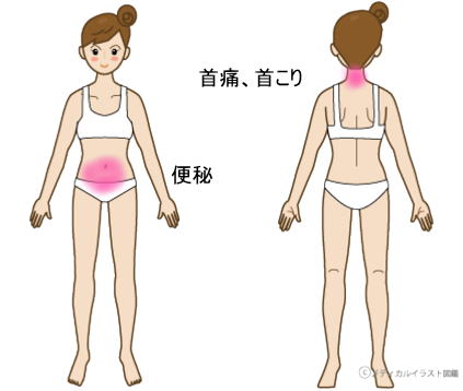 症例報告ー首痛、便秘