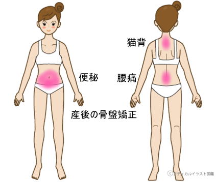 症例報告ー産後の骨盤矯正、便秘、腰痛