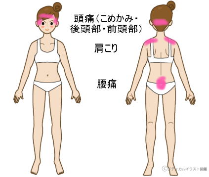 症例報告ー頭痛・肩こり・腰痛