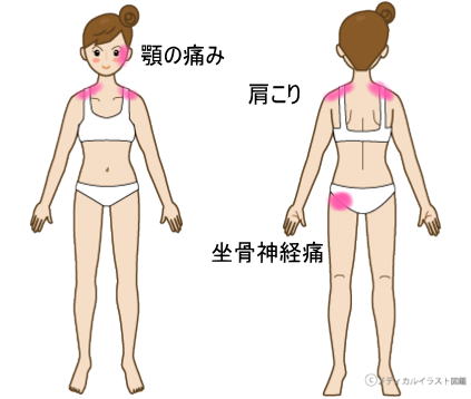 症例報告ー顎の痛み