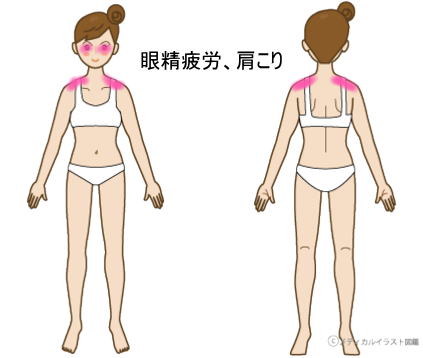 症例報告ー肩こり・眼精疲労