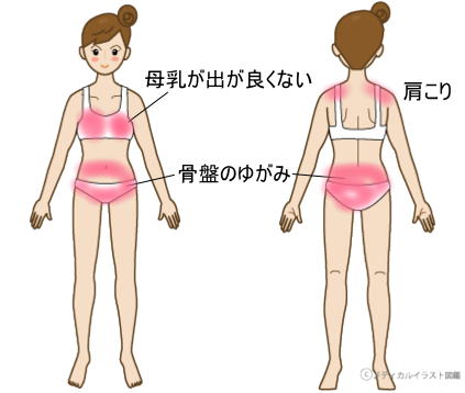 症例ー骨盤矯正、母乳の出が悪い