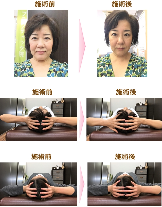 整顔ビフォーアフター