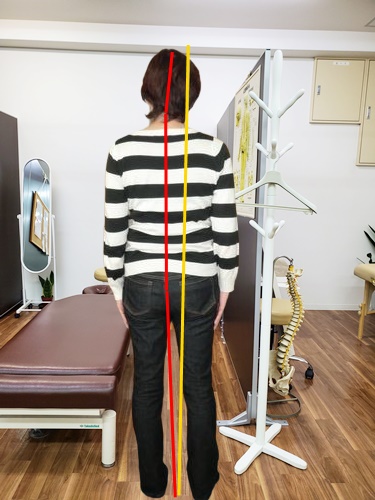 before画像